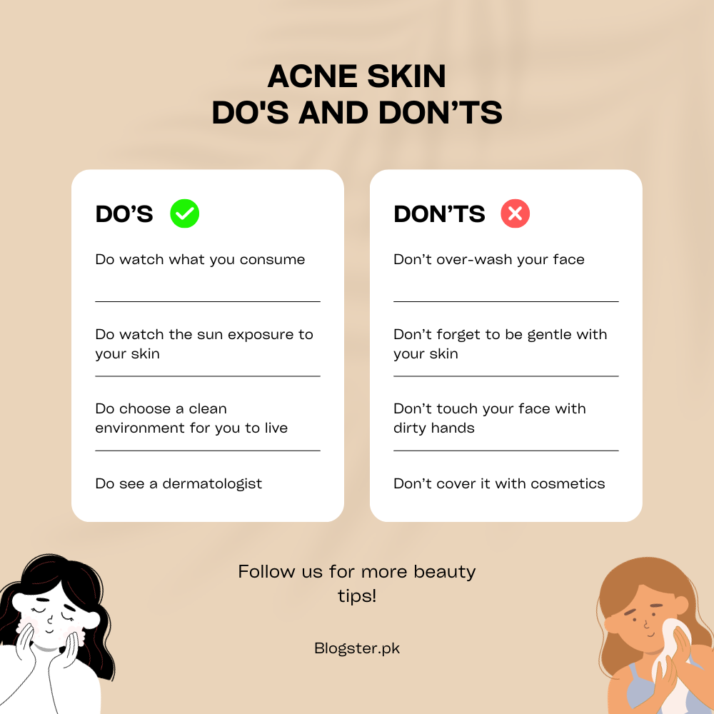 Acne treatment blogster.pk