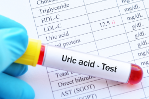 Understanding Uric Acid - Its Impact on Health and Dietary Solutions